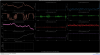 34025_1748847801_683d0ca91fd866006cceef25.png